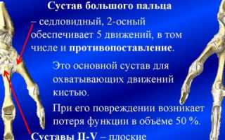 Суставы на руках
