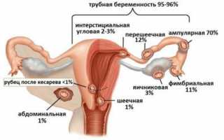 Когда видно беременность на УЗИ. На каком сроке видно беременность по УЗИ. Почему на УЗИ не видно беременности