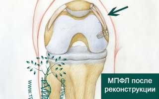 Вывих плеча и физнагрузки: что можно, а что нельзя?