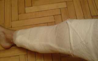 Лангета на коленный сустав