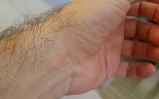 Почему дергаются пальцы на руках?