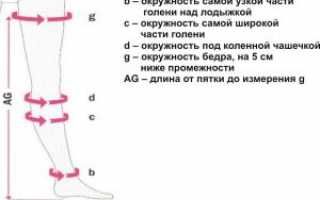 Чулки после замены сустава