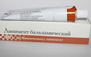 Мази при гигроме