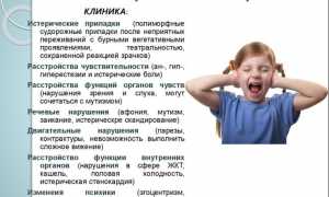 Истерический невроз – болезнь или натура?