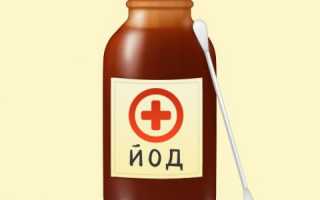 Йод для лечения суставов