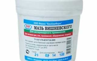 Отекла нога из-за подагры