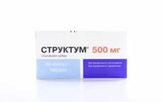 Как отличить стенокардию от остеохондроза?