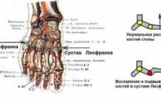 Суставы Шопара и Лисфранка