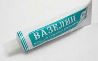 Лечение суставов ультразвуком с гидрокортизоном