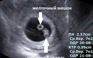Что означает желточный мешок при беременности. Размеры по неделям и нормы желточного мешочка во время беременности